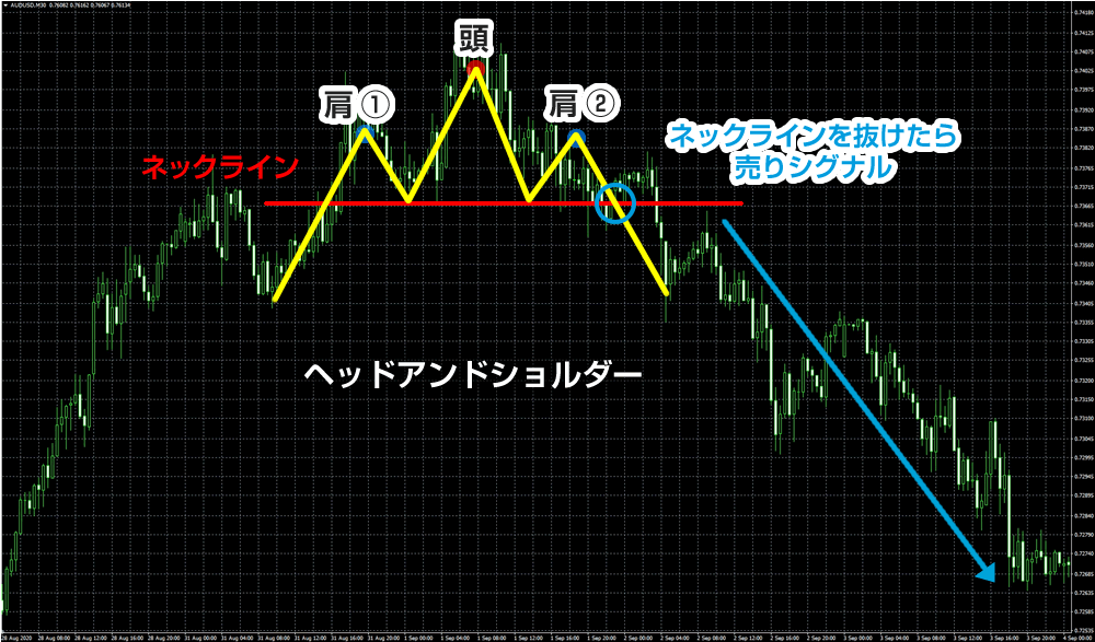 ヘッド&ショルダー