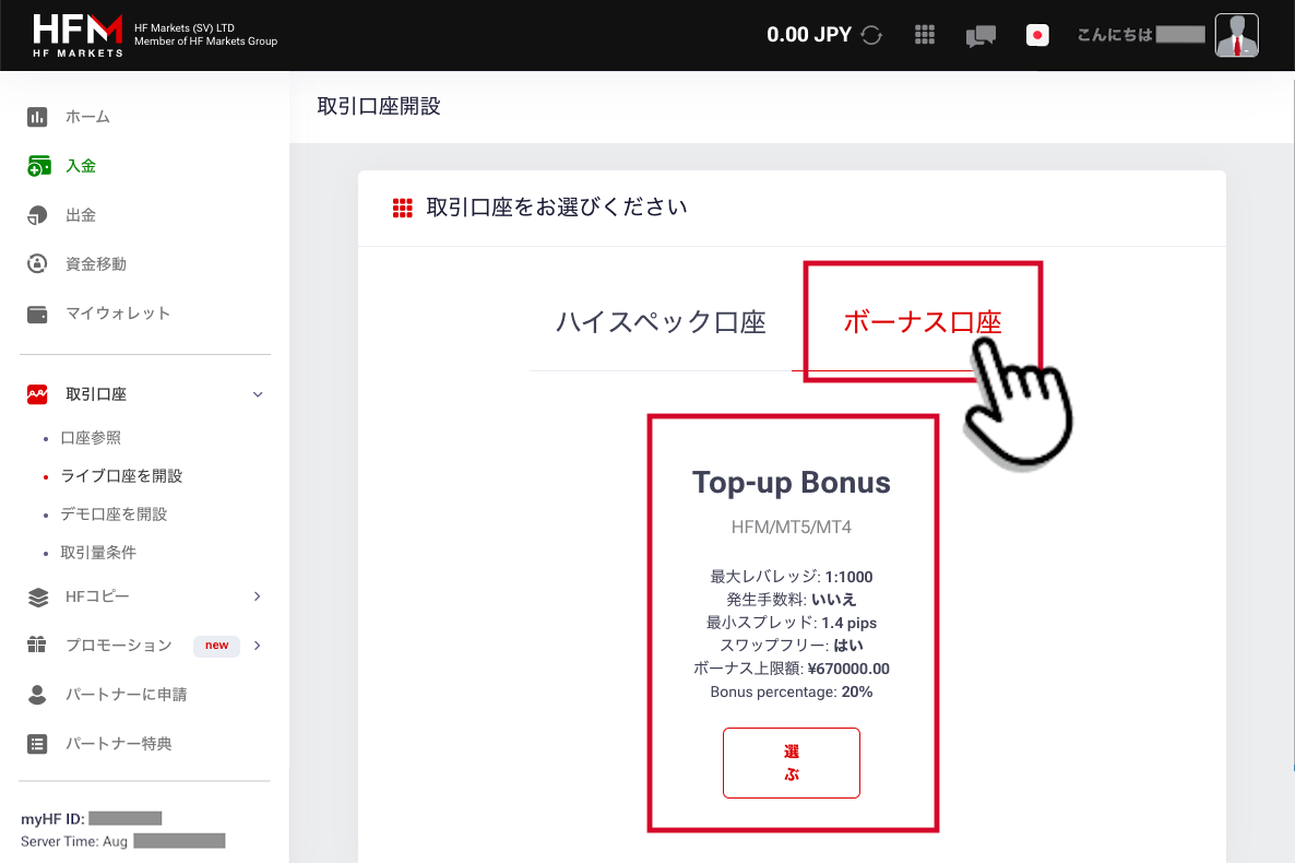 HFM-Top-up Bonus口座を開設